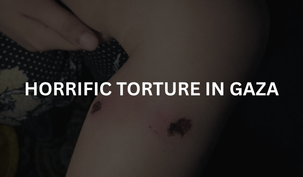 Torture-in-gaza