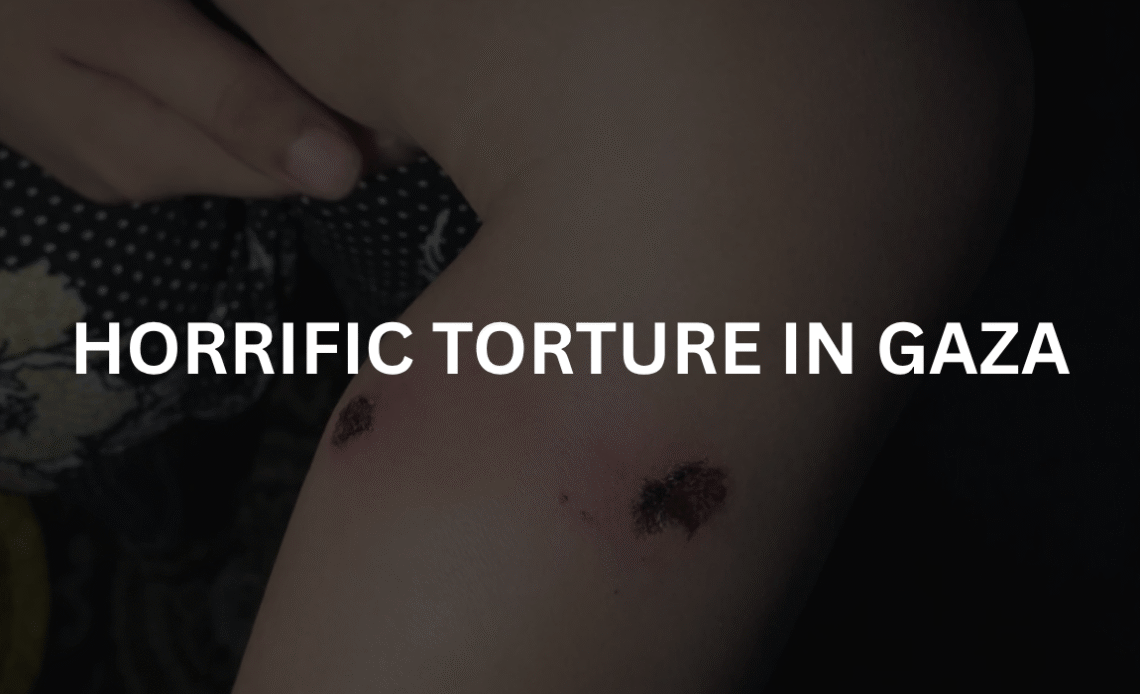 Torture-in-gaza